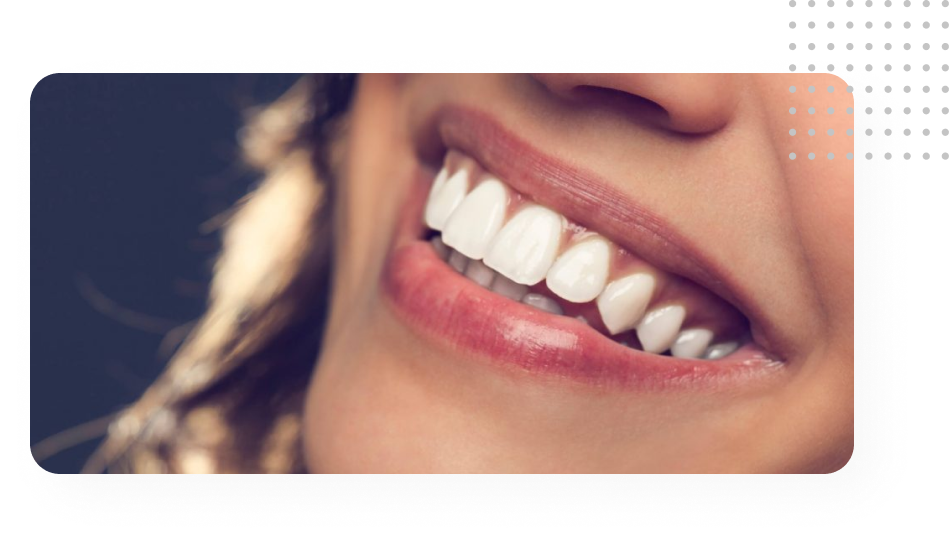 Imagem Odontologia Estética / Dentística